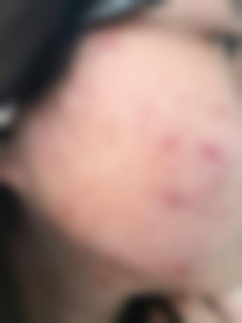 四、中山季远翔皮肤专科门诊部特色项目