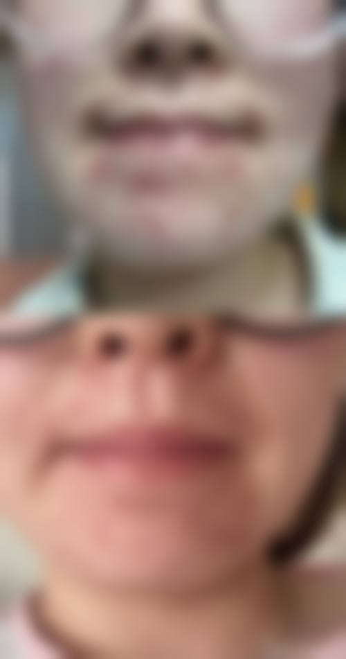 七、中山季远翔皮肤专科门诊部预约方式