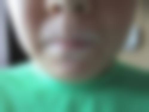 五、中山季远翔皮肤专科门诊部价格表