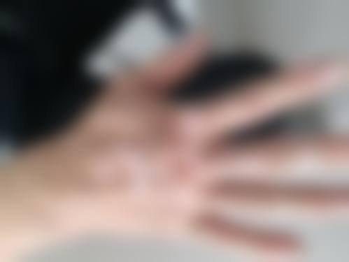 八、中山季远翔皮肤专科门诊部真实的患者评价