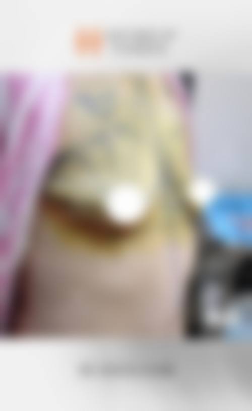 八、上海发之初植发门诊部真实的患者评价