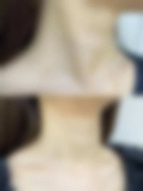 七、揭阳华美整形美容医院预约方式