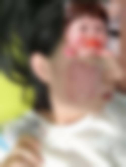 八、佛山美莱整形医疗美容医院预约方式