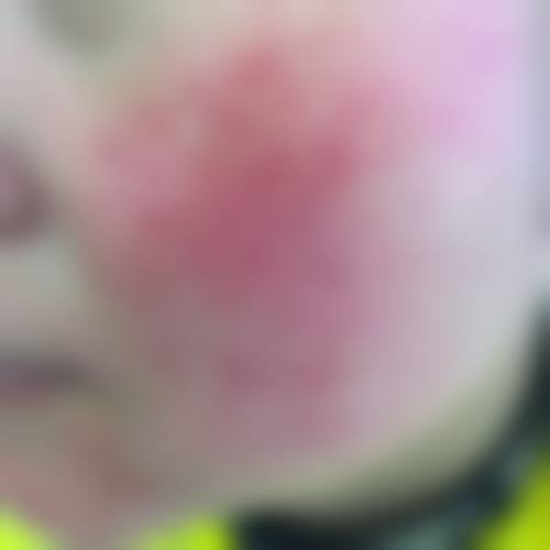 六、佛山美莱整形医疗美容医院价格表