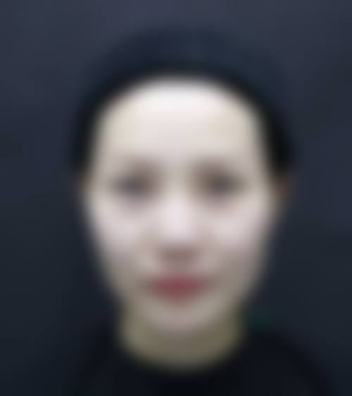 五、邯郸爱眼医院整形美容医院价格表