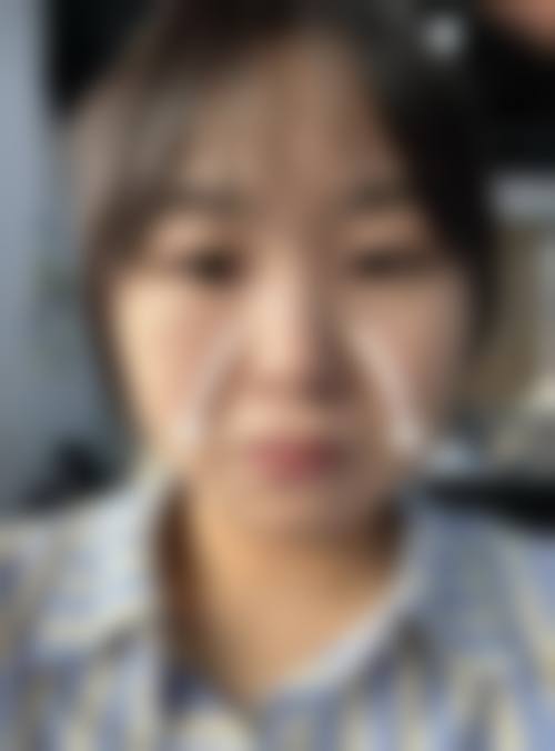 四、邯郸爱眼医院整形美容医院特色项目