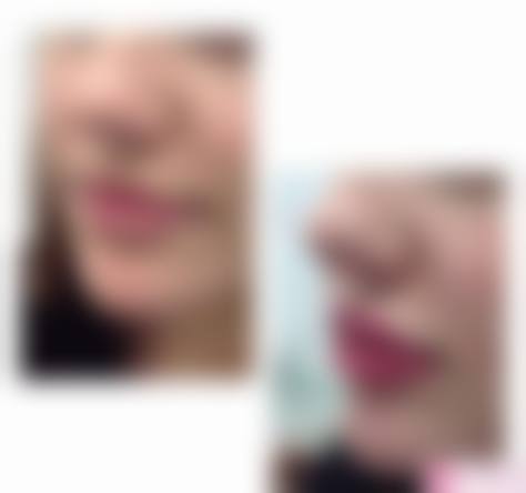 七、上海发之初植发门诊部预约方式