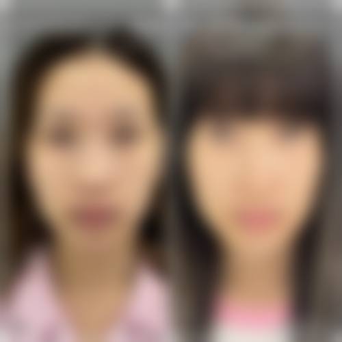 八、深圳星美度医疗美容门诊部真实的患者评价