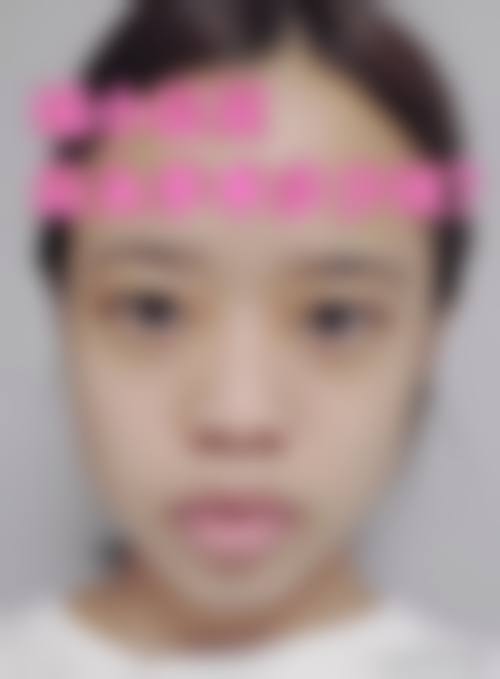 四、济南丽珍美容医院特色项目