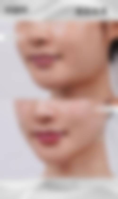 五、上海发之初植发门诊部价格表