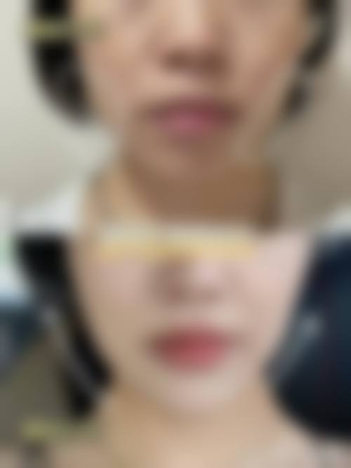 重庆瑞季整形医院真实的患者评价