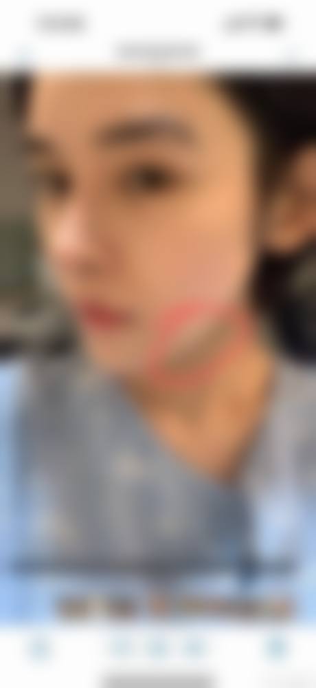 四、佛山美莱整形医疗美容医院特色项目