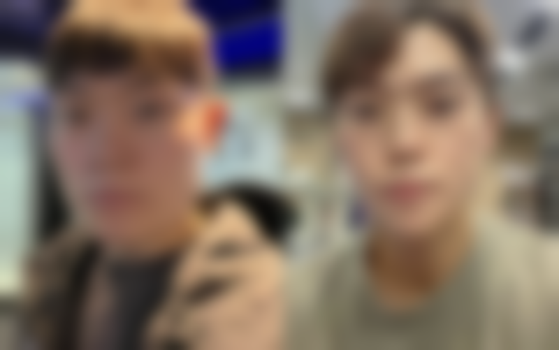 二、不同鼻部情况1毫升玻尿酸的适用性