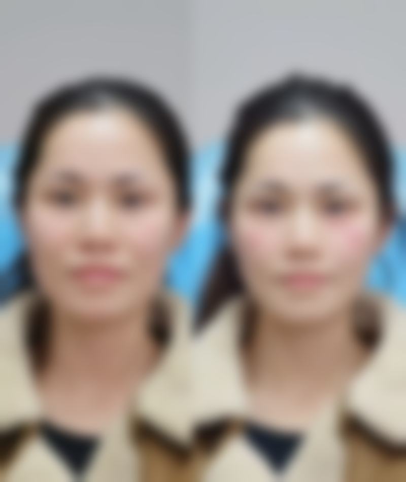 六、揭阳华美整形美容医院地址及交通