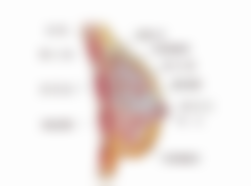 三、抽脂更多一次可以抽多少：过量抽脂的潜在风险