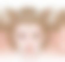 三、适合先做双眼皮的情况