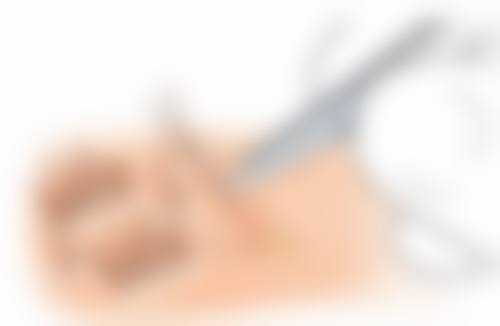 三、南京瑞丽诗植发医院诊疗项目有哪些？