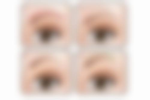 一、提眉和双眼皮手术顺序的决定因素