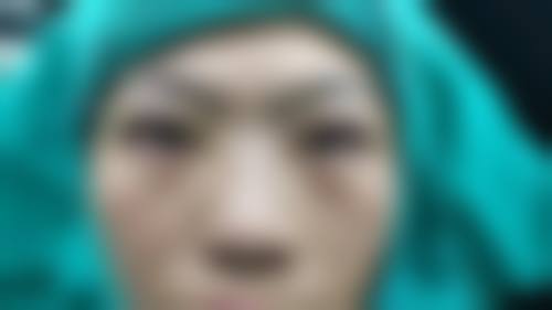 九、永州市皮肤病医院医疗美容科真实的患者评价