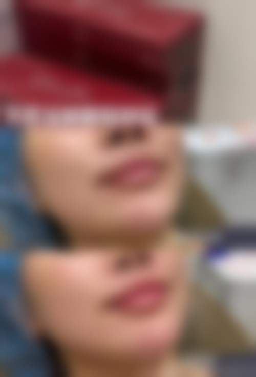 三、沈阳维康医院皮肤美容科诊疗项目有哪些？