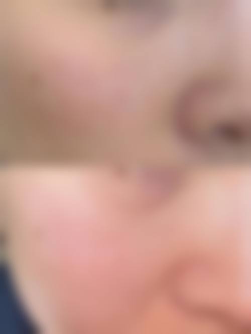 二、长治高新区悦美医疗美容怎么样？