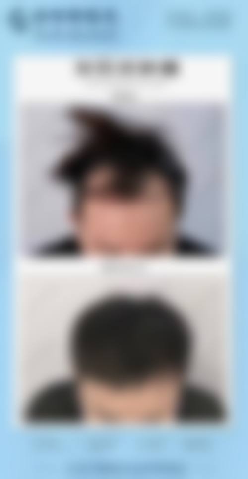 四、郑州一美医疗美容门诊部特色项目