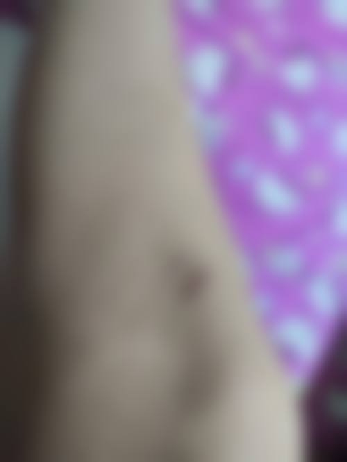 四、无锡佳新颜整形医院特色项目