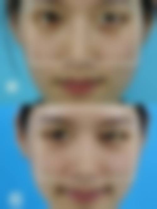 五、怀仁韩涵整形医院价格表