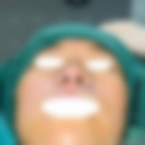 四、西安蛋壳肌医疗美容诊所特色项目