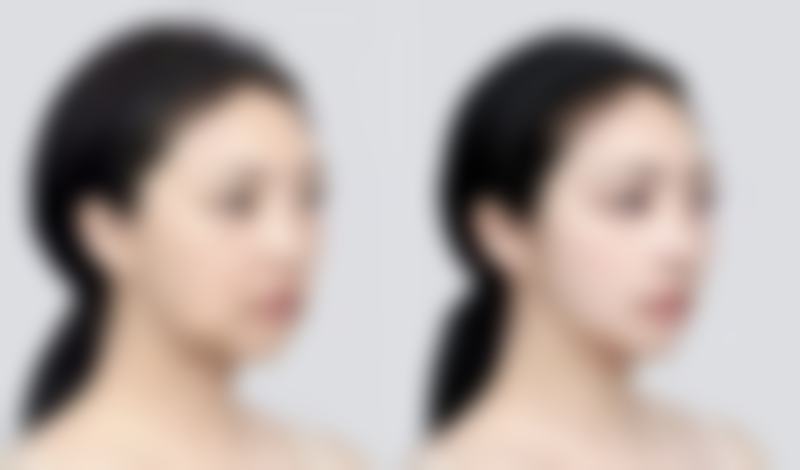 四、永州市皮肤病医院医疗美容科特色项目