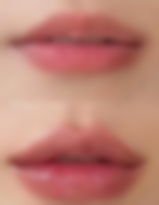 二、日常护理要点助消肿