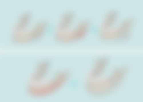 五、做双眼皮之术前准备时间轴