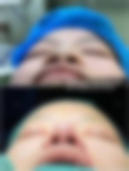 八、怀远县美茜整形医院真实的患者评价