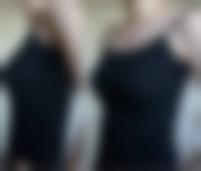 四、重庆珂琳雅整形美容门诊部特色项目