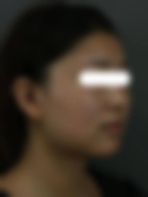 七、韩国LH整形外科医院预约方式