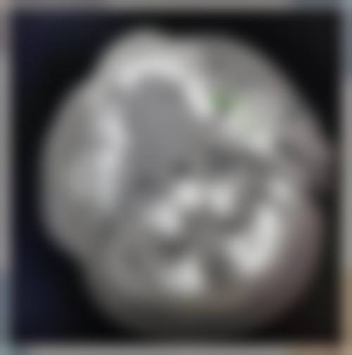 七、首都医 科 大学附属北京同仁医院(医学美容中 心)地址及交通