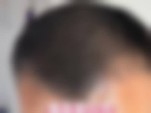 三、陈慧敏技术优势