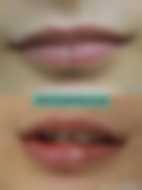 三、中山一院皮肤美容科诊疗项目有哪些?