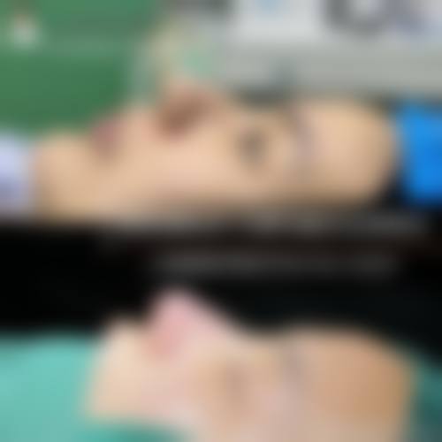 四、深圳芙娜伊美整形医院特色项目