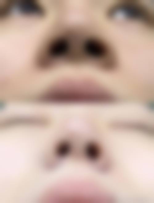 八、上海生命树整形美容门诊部真实的患者评价