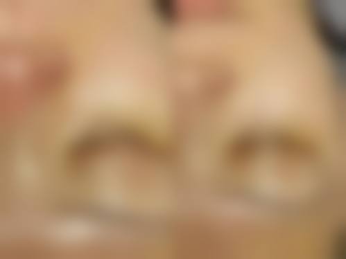 六、韩国梅宗德 M 皮肤科医院价格表