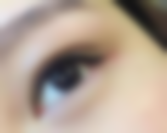 六、美学修复的要点