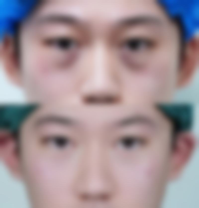 八、韩国韩亚整形外科医院预约方式