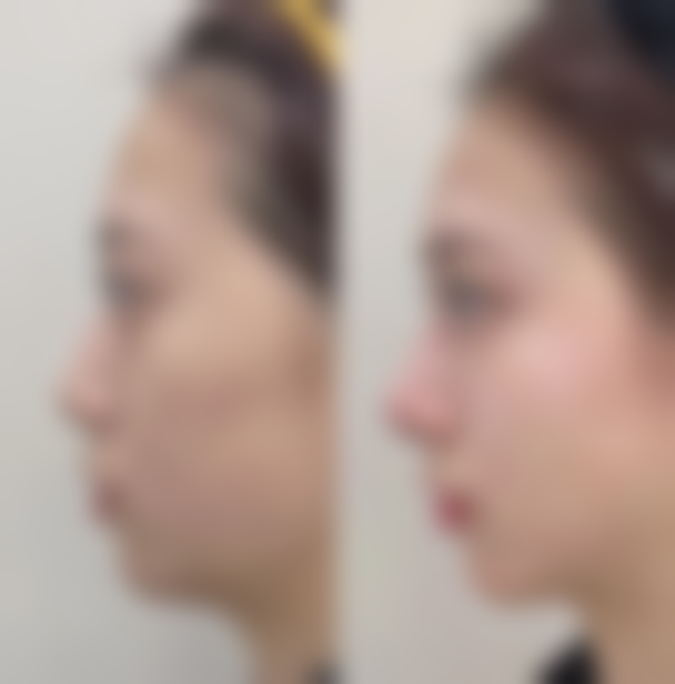 五、河南瑞德整形医院价格表