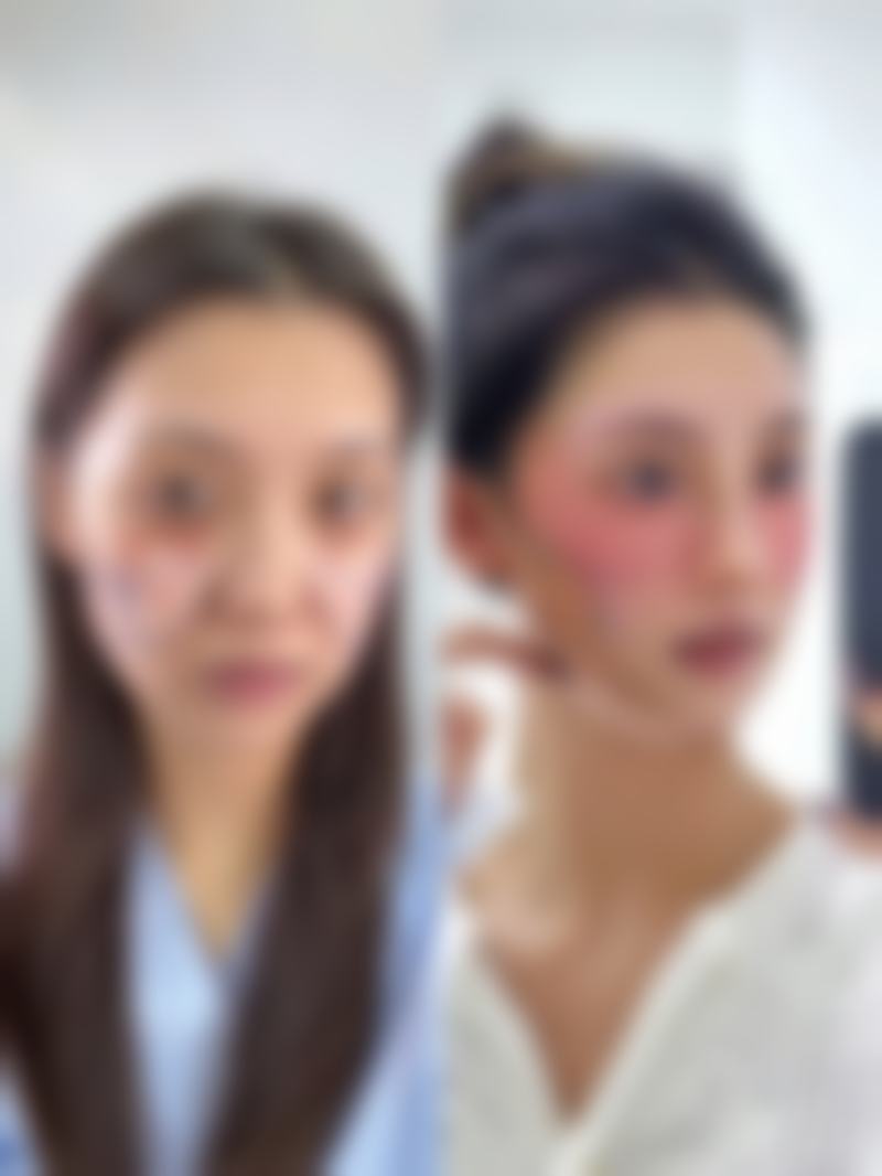 二、怎样让小阴唇自然缩小之非手术方法