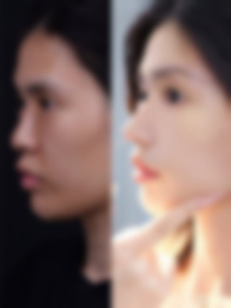 七、怀远县美茜整形医院预约方式