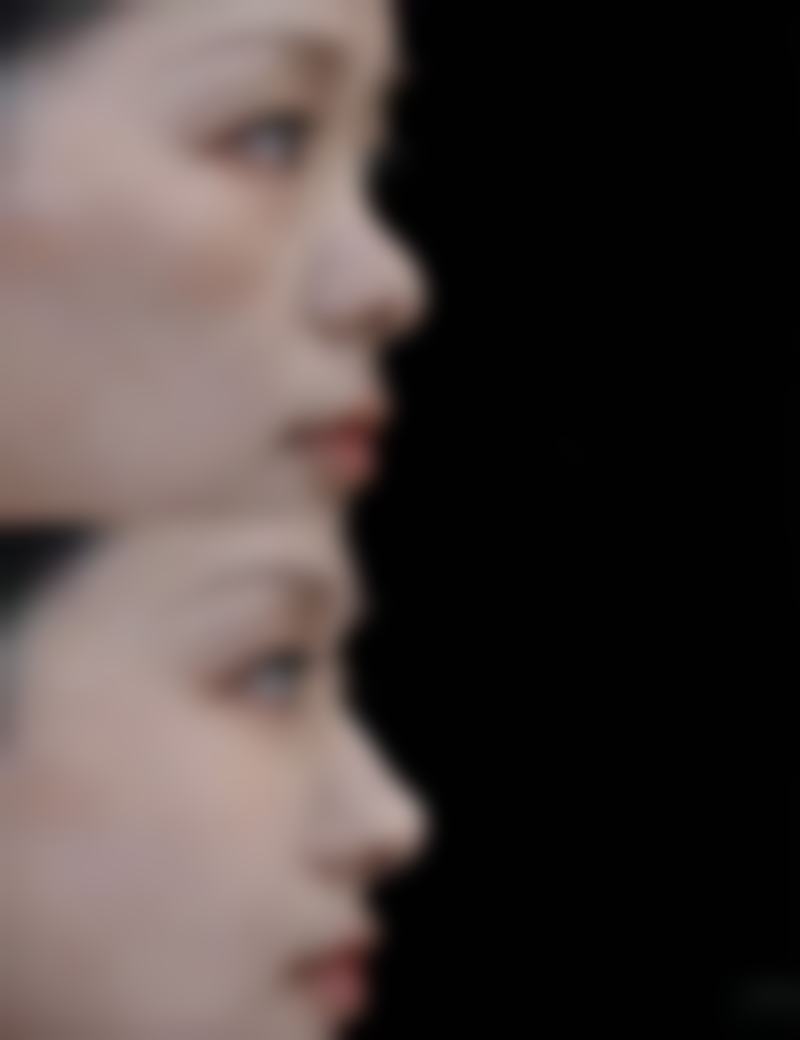 一、男人眼袋形成的原因