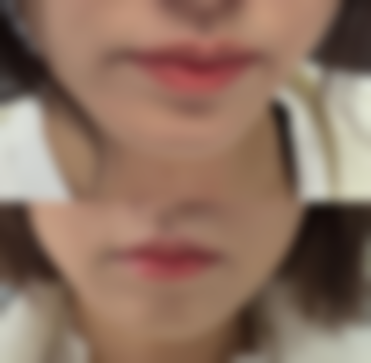 八、青岛颖逸整形医院真实的患者评价