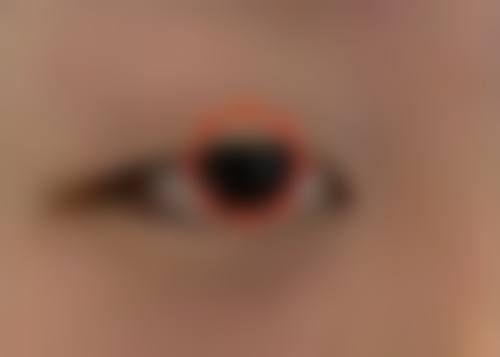 五、秦玲怎么预约？