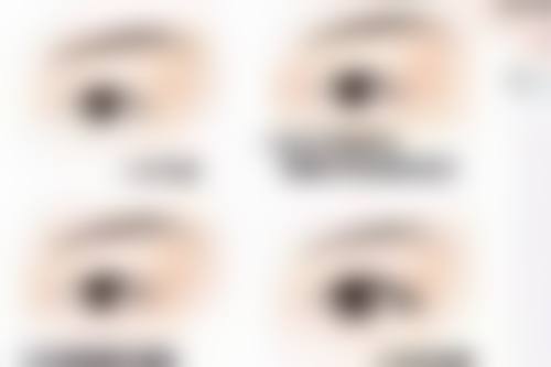 五、影响修复速度的因素